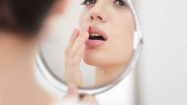 Mujer con dolor en su labio por herpes labial Mujer con dolor en su labio por herpes labial