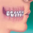 crossbite teeth and orthodontics - colgate in