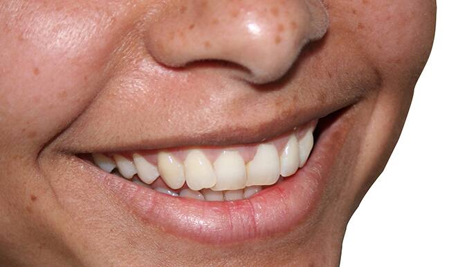 close up of a mouth