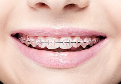Cepillo interdental Colgate