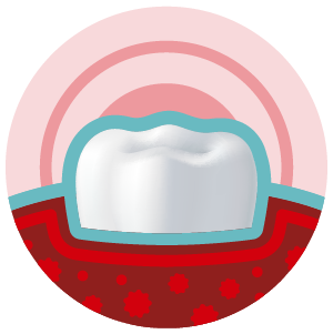 Healthy Gums