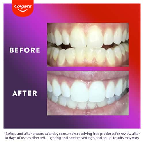 Whitening Toothpaste Colgate Max White One Luminous