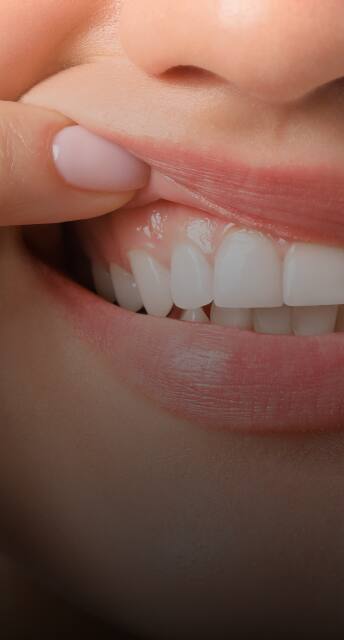 woman smiling showing white teeth