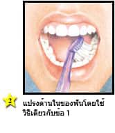 การแปรงฟันที่ถูกวิธี - แปรงด้านในของฟันอย่างแนวขนานกับเหงือก