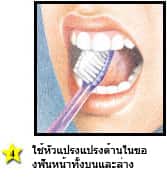 การแปรงฟันที่ถูกวิธี - ใช้หัวแปรงแปรงด้านในของฟันหน้าทั้งบนและล่าง