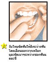 ไหมขัดฟันพลังน้ํา - จีบไหมขัดฟันให้ดึงระหว่างฟัน