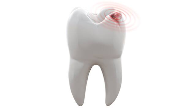 Toothache Toothache