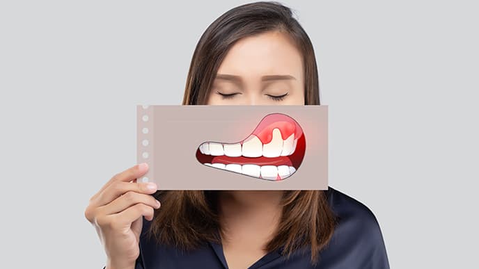 Woman with bleeding gums picture