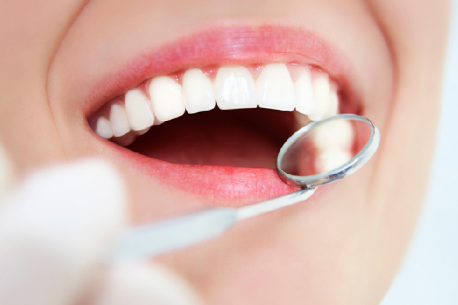 Woman with perfect teeth getting a checkup to prevent tooth decay