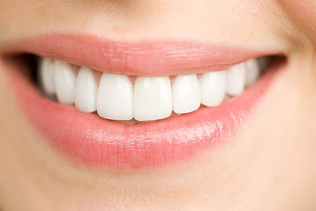 Dientes libres de sarro dental: 4 formas simples de prevenirlo y mantener una sonrisa saludable 