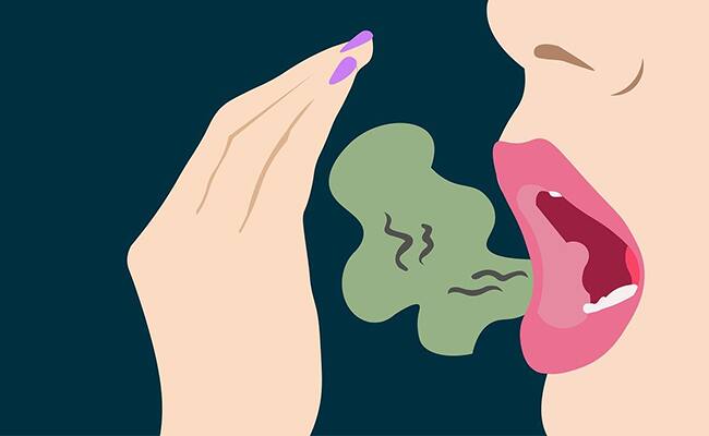 ağız kokusu nasıl tedavi edilir