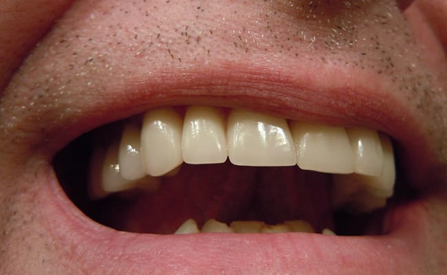 Colgate gülümsemesini gösteren kişi