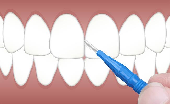 Diş çiziminde dişlerin nasıl temizleneceğini gösteren kişi